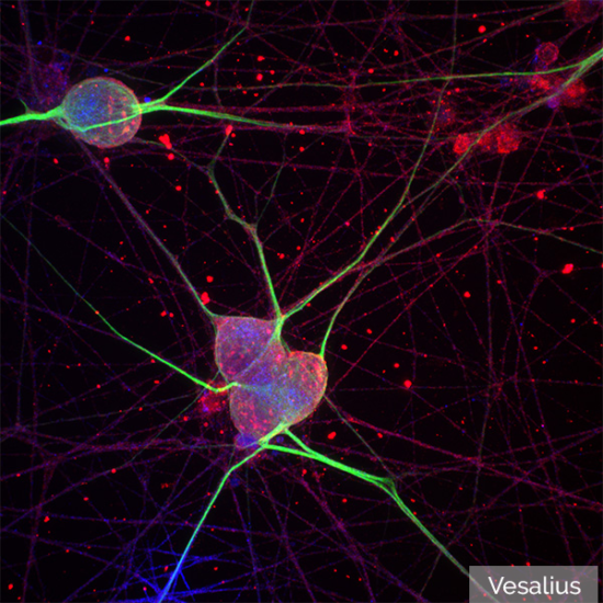 Vesalius® - MBF Bioscience