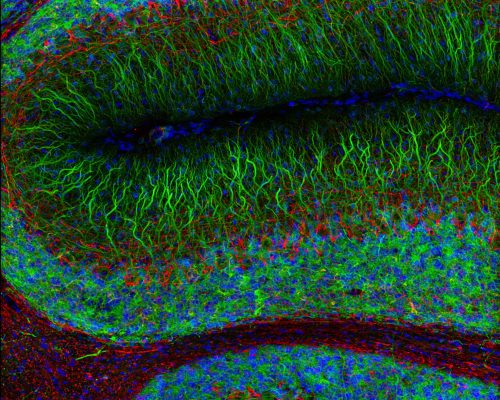 Rat Brain cerebellum acquired with 40x/0.75 NA objective on Vesalius. Tissue was labeled with Hoechst (blue), MAP2-conjugate (green), and RPCA-NFL-ct (red). Slide prepared and provided by Encor Biotechnology Inc.