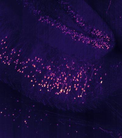 CLARITY cleared Thy1-eYFP mouse brain imaged with 16x objective. Image courtesy of the Tomer Lab